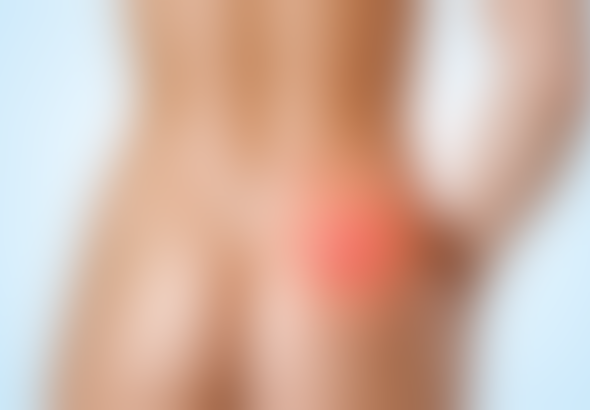 découvrez comment reconnaître les premiers symptômes du kyste pilonidal afin d'agir rapidement et éviter les complications.